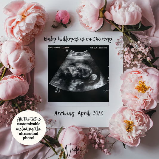 EDITABLE Peony Summer Pregnancy Announcement Digital, Flower Baby announcement, Instagram Pregnancy Reveal Flower Announcement Download 0268