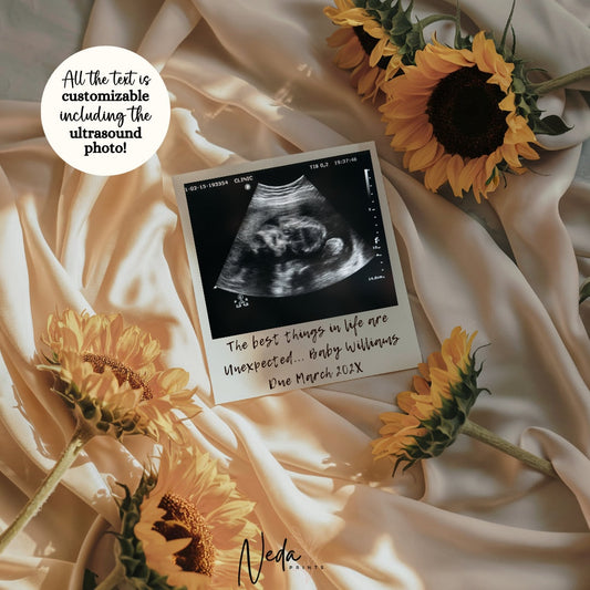 EDITABLE Summer Pregnancy Announcement, Sunflower Baby Announcement, Social Media Instagram Pregnancy Reveal Announcement, Download, 0366