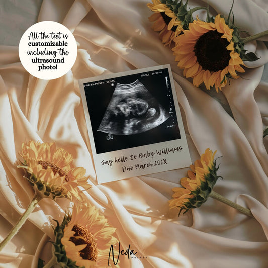 EDITABLE Summer Pregnancy Announcement, Sunflower Baby Announcement, Social Media Instagram Pregnancy Reveal Announcement, Download, 0367